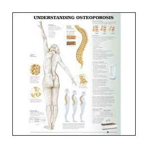  Understanding Osteoporosis Anatomical Chart 20 X 26 
