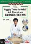 Traditional Chinese Medicine Cures All Diseases   Cupping Therapy for 