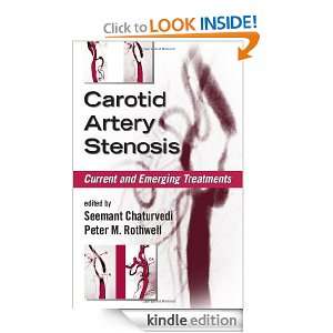 Carotid Artery Stenosis Current and Emerging Treatments (Neurological 