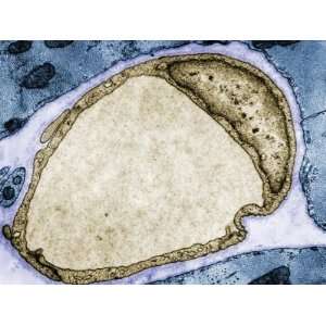 Cross Section of a Capillary in Cardiac Muscle. Tem Photographic 