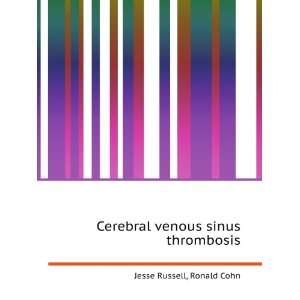 Cerebral venous sinus thrombosis Ronald Cohn Jesse 